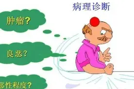肺癌患者如何看懂病理报告？图片