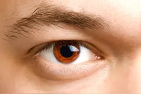 为何眼睛也会长结石？提醒：离不开2个因素，5类人要格外注意图片