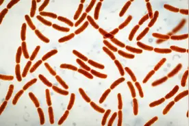 肠道微生物群如何影响您的健康图片