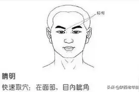 安军明教授谈穴位治疗近视——睛明穴图片