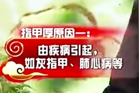 医生开讲：指甲厚有原因，指甲变厚别忽视，专家教你养生护甲小炒视频封面