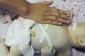 超预产期4周宝宝还没动静，安全起见剖腹产，宝宝出生后护士泪目图片