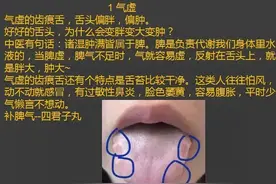 以为齿痕重就是有湿气了？错了，还有可能是这4种情况图片