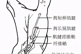 我只是手腕痛，怎么会得鼠标手呢？图片