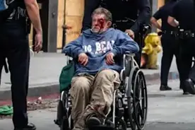 美国警察下手真狠，连坐轮椅的流浪汉都被打得满脸是血，舆论炸锅图片