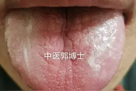 郭博说舌象（1）如何判断脾虚湿阻，肝气不疏，胃阴虚热，血糖高图片