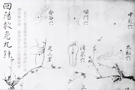 回阳九针穴图片