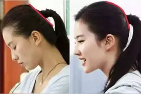为啥老人都爱给娃睡扁头？几个月后才发现，影响的不仅仅是颜值图片