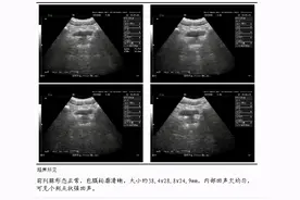前列腺患者出现性功能衰退，应尽早检查治疗，而不是补肾壮阳图片