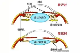 【医学探秘】你的清晰视界，是怎么运行的？图片