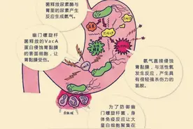 幽门螺旋杆菌的诊疗与防治图片