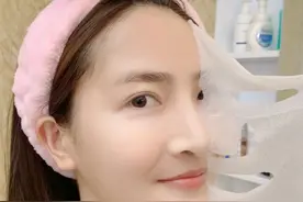 三种常见的黑眼圈类型，如果不搞清楚，就算用天价的眼霜也是白搭图片
