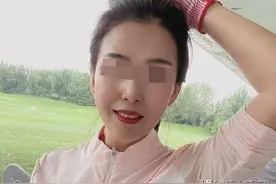 全脸做自体脂肪填充，2年后，脸变成了什么模样？图片