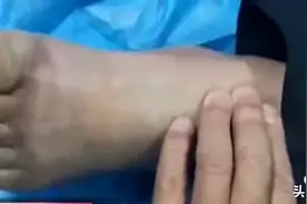 男子醉酒睡街头，四肢冻僵面临截肢，同桌饮酒该担责吗？图片