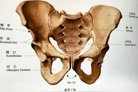 学习《X线读片指南》骨、关节系统——骨盆图片