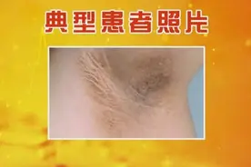 脖子黑是胃癌先兆？皮肤上的这些变化是癌症信号，看不见就危险了图片