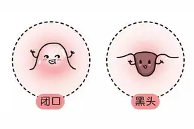 天天都在补水，但是你真的做对了吗？图片