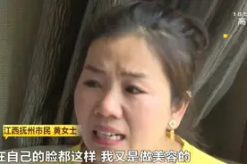 招商会体验祛斑，美容院女老板脸上竟留了疤！机构仅支付部分医药费，当事美容师：已离职、随你找…图片