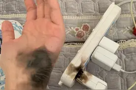 太吓人了！女子拔插头引发爆燃，手掌黑了一大片图片