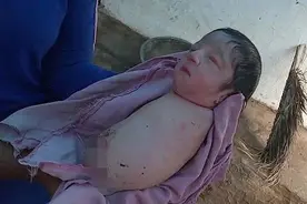 太惨了！28岁印度女子，竟生下天生无四肢的孩子图片
