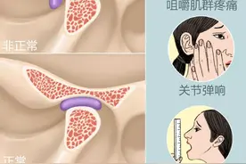 一张嘴“咔吧咔吧”响，脸还歪了，小心！你可能得了“ＴＭＤ”图片