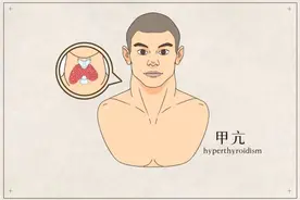 58岁的她脾气像火药桶，以为是更年期的缘故，医生一查，竟另有原因图片
