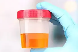 浓烈而刺激难闻的尿味可能是这些原因导致图片