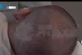 奶奶一个小疏忽，刚满月宝宝脑出血，抱孩子时几个常见错误要避开图片