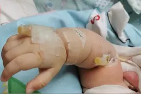 6月大女婴被楼上掉落的洗发水砸中 家属：孩子头骨骨折还在危险期图片