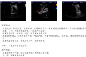 生死时速 | 七岁男童车祸大出血，脾脏碎成豆腐渣还能救活吗？图片