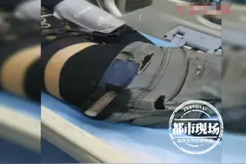 男子高空坠落，半米长钢筋插入盆腔，医生：他太幸运了图片