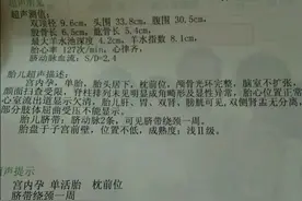 什么是双顶径？用双顶径预估胎儿的体重准确吗？这些影响孕妇须知图片