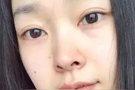女星卸妆照模板，开眼角的疤都清晰可见！其他伪素颜学学吧图片
