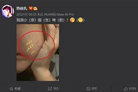 热依扎晒出“受伤照”，脸被宝宝挠出血，宝妈们：家有同款图片