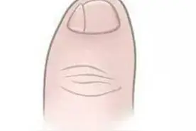 小脚趾甲上分两瓣的人，才是纯正的汉族血统？看看专家怎么说图片
