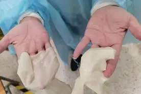 每天穿17个小时防护服，他有双被汗水泡白的“抗疫手”图片