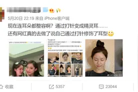 网红流行的”精灵耳”是什么？教你0成本拥有精灵耳图片
