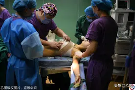 整形医生十年为千名女子手术，有明星也有大学生，尴尬的事一箩筐图片