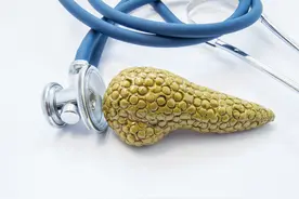 胰腺癌：从确诊到死亡，不足半年，1个典型症状，提醒你别忽视图片