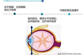 按摩等手段能提高视力，治疗近视吗？图片