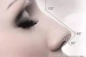 假体隆鼻后遗症如何避免图片