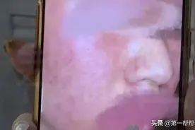 美容变“毁容”？经查女子竟是遇上无医疗资质美容机构图片
