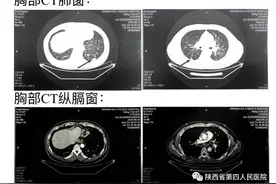 小镜子大“视”界，疑难疾病不再难图片