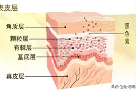 为什么会出现色素沉着？图片