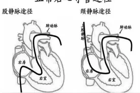 除了治疗功能障碍，西地那非还有4种作用，多点了解没坏处图片