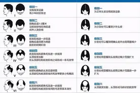 “打怪”防脱看等级，千方百剂菁纯头皮养护精华全搞定图片