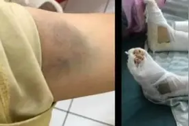 从二楼跳下，竟成为她逃脱家暴的唯一出路 白岩松：别用他人的暴力惩罚自己图片