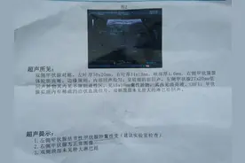 查出甲状腺结节，报告单上若没有这几个“字样”，就不用太紧张图片