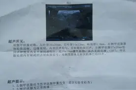查出甲状腺结节，报告单上若没有这几个“字样”，就不用太紧张图片