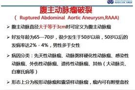 腹主动脉瘤破裂的影像学表现图片
